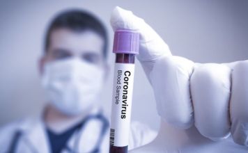 2.917 νέα κρούσματα-187 διασωληνωμένοι-29 θάνατοι από τον κορωνοϊό