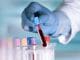 COVID TESTS στην… πρώτη γραμμή και ΒΟΗΘΕΙΑ ΣΤΟ ΣΠΙΤΙ