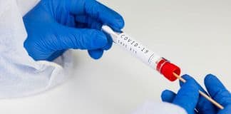 RAPID TESTS στην κεντρική πλατεία Αγίας Παρασκευής