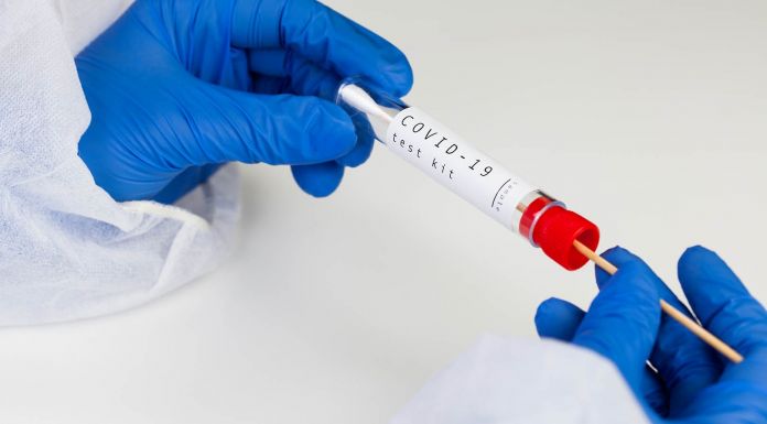 Τεστ ανίχνευσης Covid-19 για τους πολίτες, το 9ο κατά σειρά στο Δήμο Πεντέλης – Μεγάλη Τρίτη 27/4 στο Πνευματικό Κέντρο της Νέας Πεντέλης–10 π.μ. έως 2:30 μ.μ..