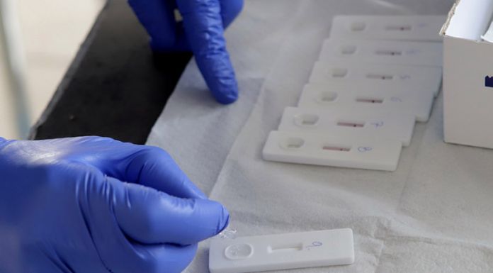 Δωρεάν rapid covid tests για τις επιχειρήσεις του Δήμου Λυκόβρυσης- Πεύκης
