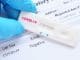 Δωρεάν rapid test στον Δήμο Χαλανδρίου τη Δευτέρα 14 Ιουνίου
