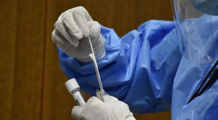 Αποτελέσματα rapid tests που διενεργήθηκαν στις 24/10 στην Αγία Παρασκευή