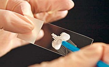 Δωρεάν τεστ PAP για τις γυναίκες της πόλης από τον Δήμο Ηρακλείου Αττικής