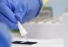 ΕΟΔΥ- 8.30-12.00 –ΤΗΝ ΠΕΜΠΤΗ ΤΑ RAPID TEST ΣΤΗΝ ΚΗΦΙΣΙΑ