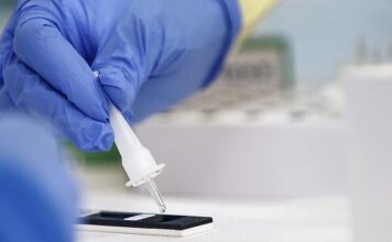 ΕΟΔΥ- 8.30-12.00 –ΤΗΝ ΠΕΜΠΤΗ ΤΑ RAPID TEST ΣΤΗΝ ΚΗΦΙΣΙΑ