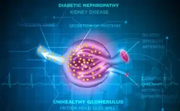 ΔΙΑΒΗΤΙΚΗ ΝΕΦΡΟΠΑΘΕΙΑ, άρθρο του ειδικού νεφρολόγου Καϊσίδη Παύλου
